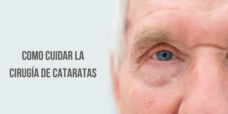 Operación de cataratas, ¿qué es? ¿cómo se hace? cuidados